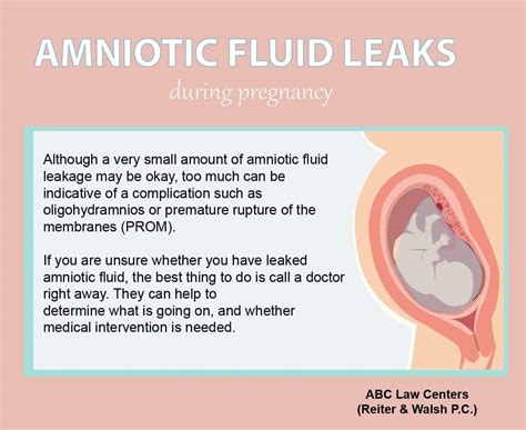 can amniotic fluid leak and then stop|Signs Of Leaking Amniotic Fluid Vs. Discharge: The。